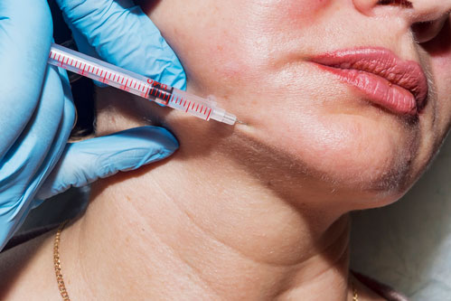 Is jowl surgery right for you? Find out all the requirements