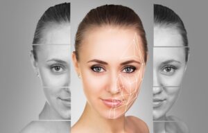 how to avoid complications from dermal fillers